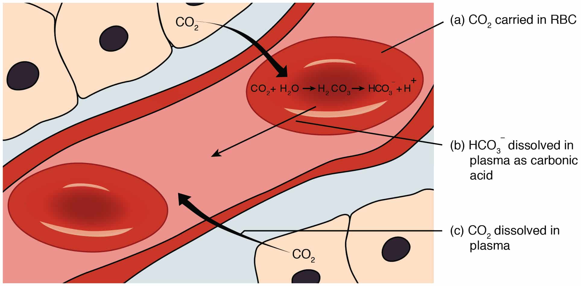 Ketoacidosis: A Clinical Reality